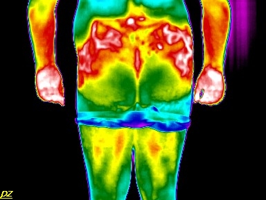 Test - hőenergia felvétel a hátgerinc betegségeiről