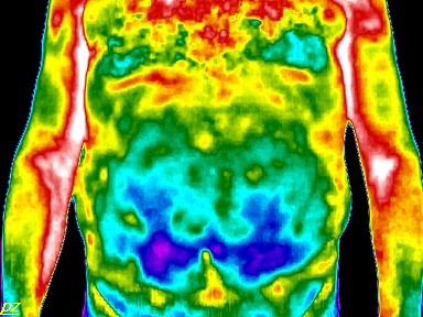 amoxicillin clavulansäure prostatitis A prosztatitis terápia kezelése
