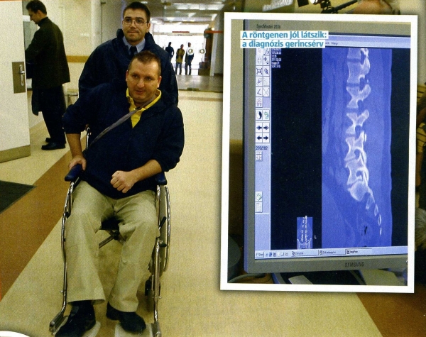 A röntgenfelvételen jól látszik a diagnózis: gerincsérv