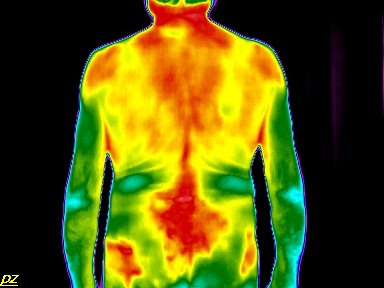 Lumbális discopathia és csipőizületi gyulladás – Test - hőenergia felvétel a hátgerinc betegségeiről