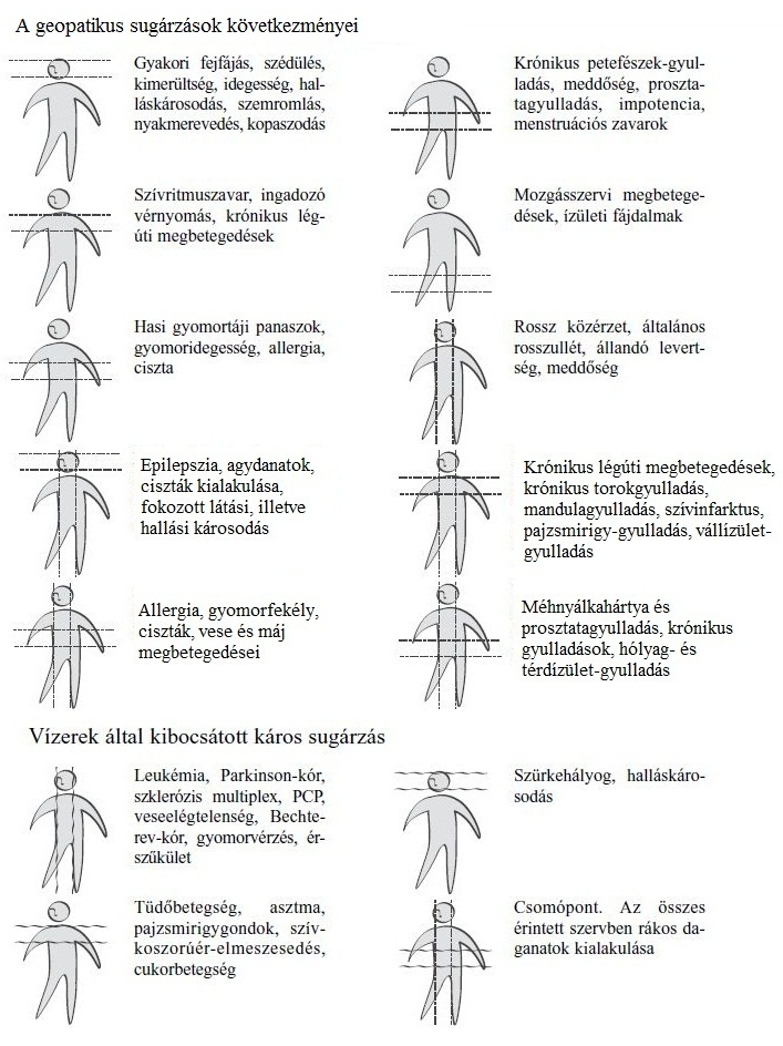 Földsugárzás – vízér – Hartmann zóna