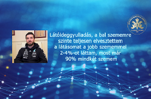 Látóideggyulladás - a bal szememre szinte teljesen elvesztettem a látásomat, a jobb szememmel 2-4%-ot láttam, most már 90% mindkét szemem