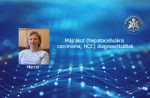 Májrákot (hepatocelluláris carcinoma, HCC) diagnosztizáltak